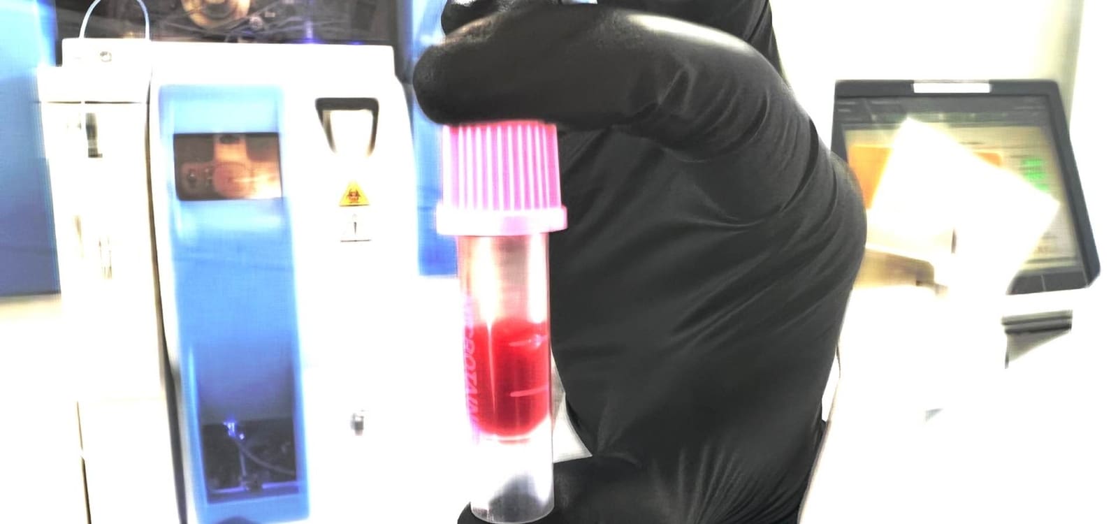 Purpletop tubes for flow cytometry and AIassisted morphology assessment